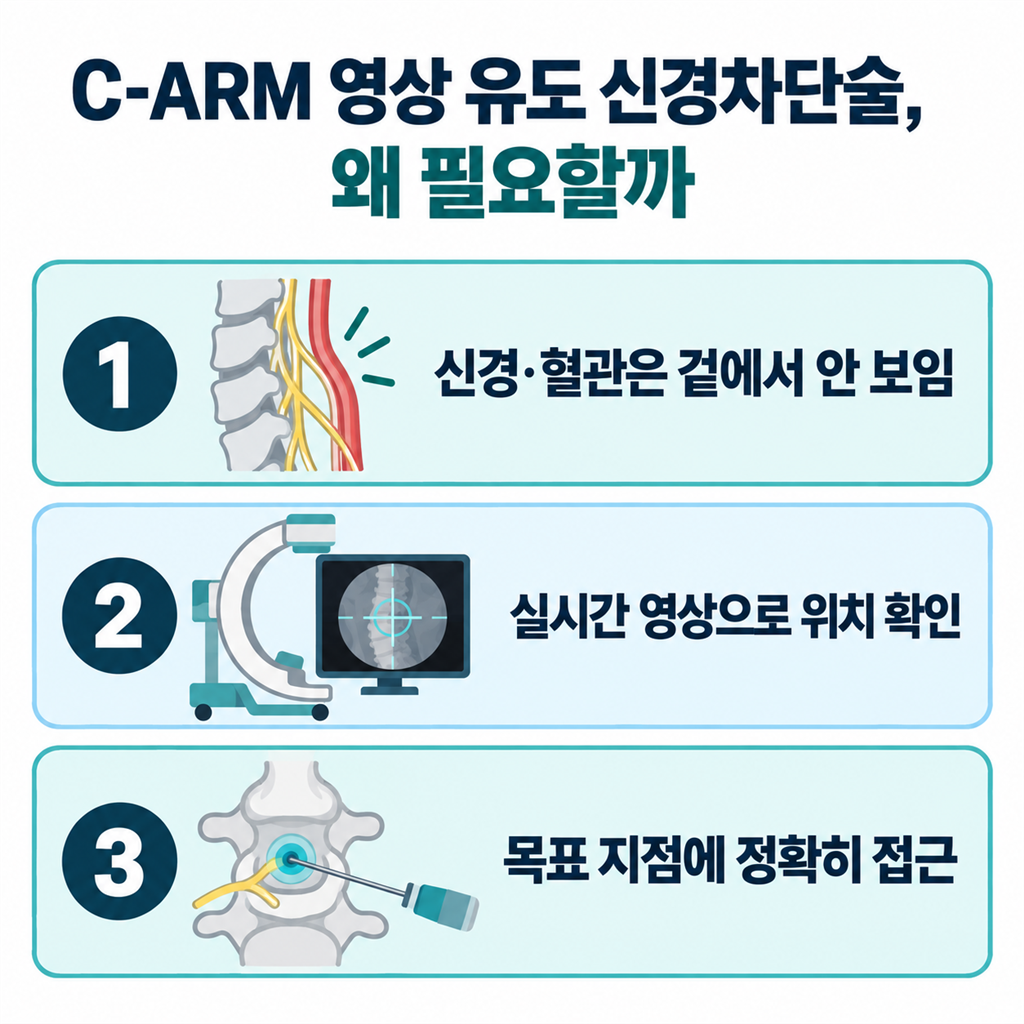 C-ARM 영상 유도 신경차단술이 왜 필요한지 정리한 안내 카드
